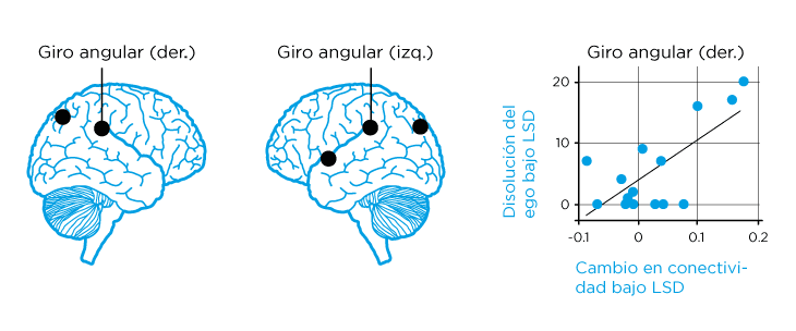 Conectividad de la corteza parietal, en la zona conocida como giro angular, bajo los efectos del LSD